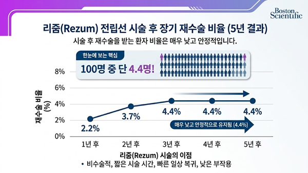 리줌 전립선 시술 후 장기 재수술 비율 5년 결과 — 100명 중 4.4명