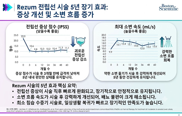 Rezum 시술 5년 장기 효과 — 전립선 증상 점수(IPSS) 감소 및 최대 소변 속도 증가